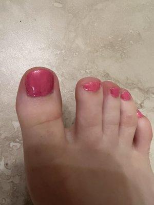 Terrible pedicure