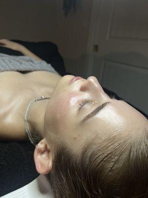 The glow after dermaplaning