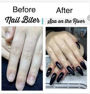 Nailbiter before & after photo