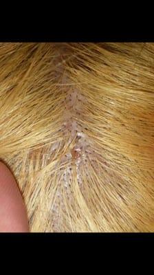 Another part of inflamed scalp.