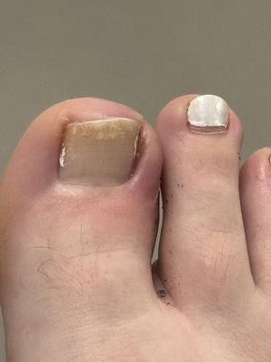 Toenail after the pedicure!