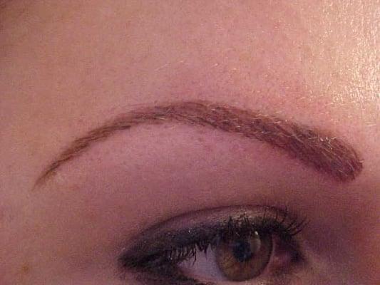 Brow Procedure, after