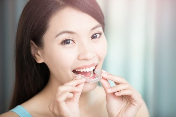 Invisalign Dentist