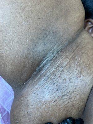 Underarm Wax