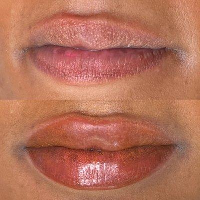 Lip Blush Nuetralization