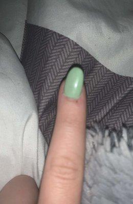 Crooked nail