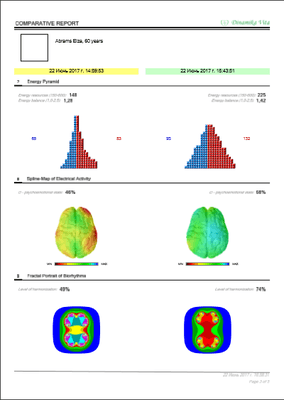 WPB's Heart Rate Variability scan's also show your Brain health and shares the factors that are causing that current condition.