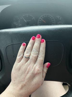 Rubber mani (post injury) mani