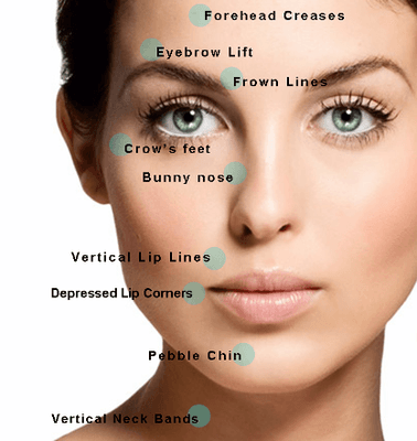 What can Botox or Dysport  do for you? All injections by Dr. Rhoad, board-certified female plastic surgeon. #nomorewrinles #smoothskin