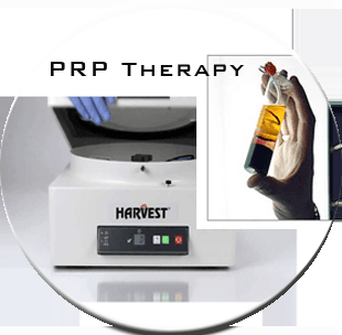 Platelet Rich Plasma or PRP is used to stimulate collagen, repair all scars, resurface stretch marks, and rejuvenate hair growth