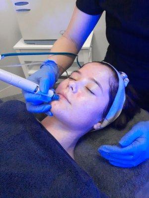 Hydrafacial extracts, cleanses, and hydrates