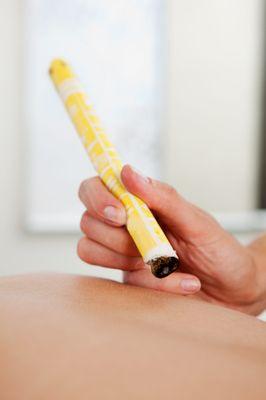 We use moxibustion to improve flow of qi. It is a heat therapy from dried plant materials called "moxa".