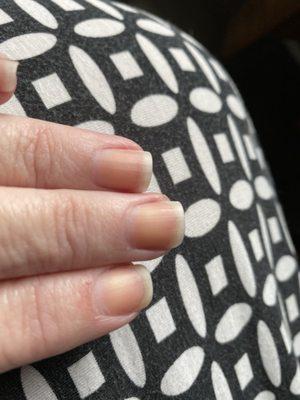 Orange stained nails, after taking off revalue polish 7 days later.