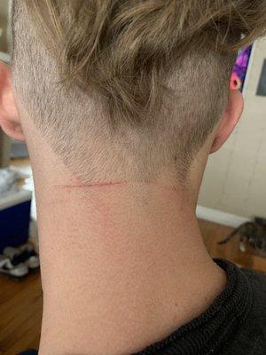 The cut across his neck!