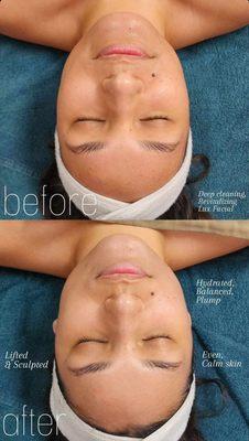 Lux Facial