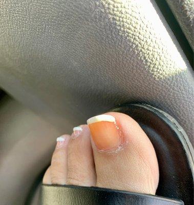 Horrible I'll looking acrylic tint.  Horrible pedicure