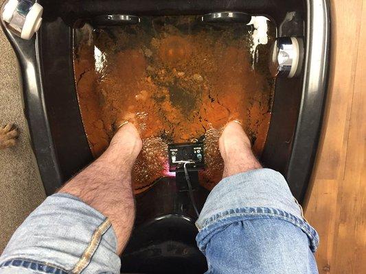 Ion cleanse detoxing foot bath.