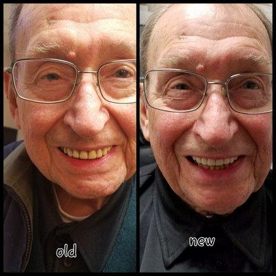 New vs. Old Dentures