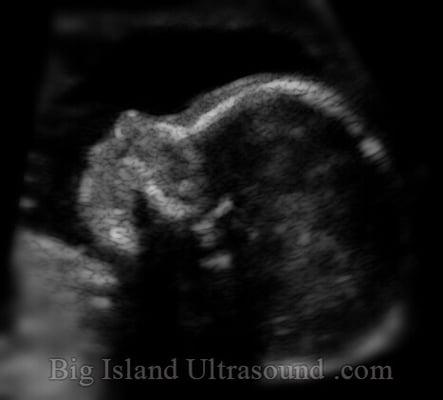 Bigislandultrasound.com