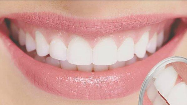 Free In-Office and Take Home Whitening for New Patients