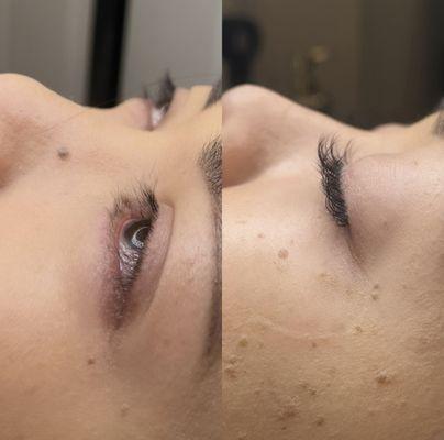 Lash extensions