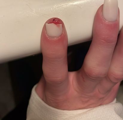 My nail broken half off by opening the door.