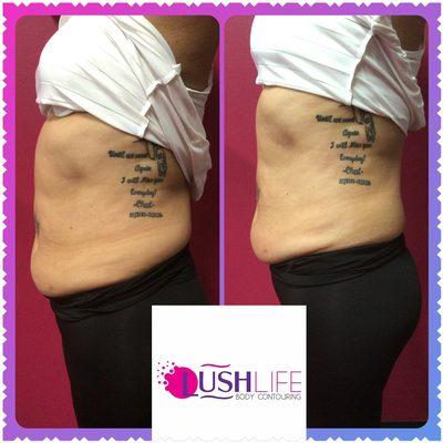 Lush Life Body Contouring