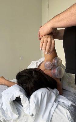 Cupping