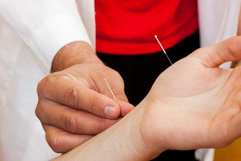 Acupuncture is effective for many conditions