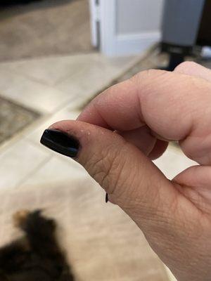 Black all around cuticle and on index finger