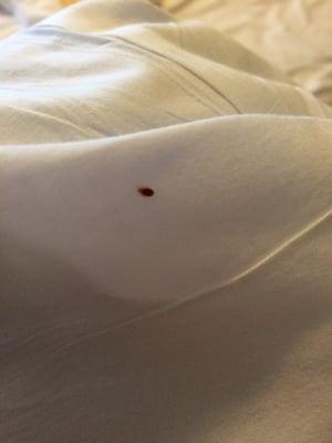 Bed bug in the bed