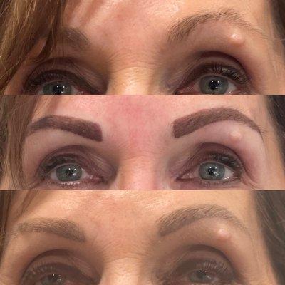 Brows!!!  Before, immediate and healed. What a statement