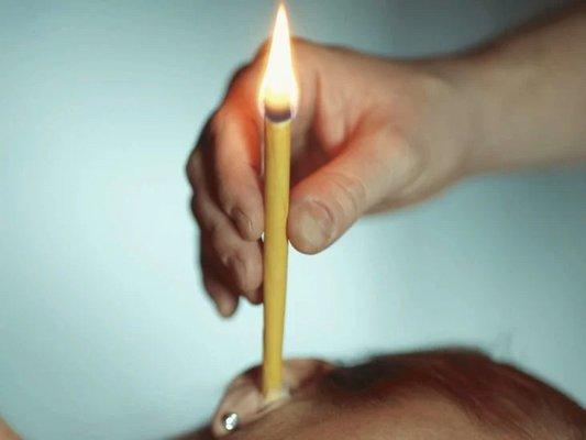 Ear Candle wax removal