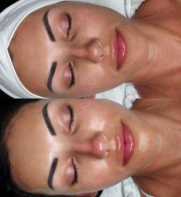 Our facials provide you with lasting results are customized to meet your skin's unique needs.