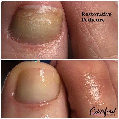 Restorative Pedicure