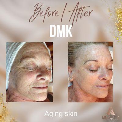 DMK enzymes therapy for aging skin