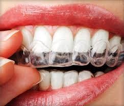 We offer Invisalign!