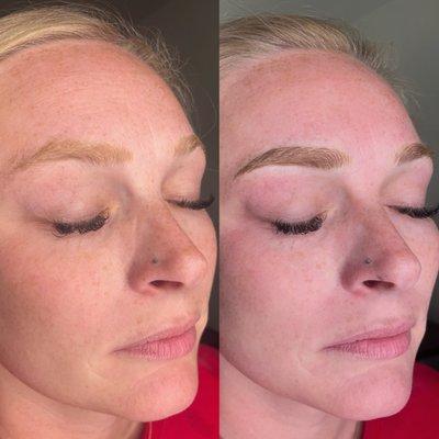 Microblading