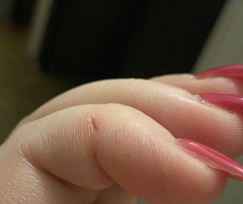 Where her shaky hands and drill cut my finger open. Because it went wild around my pinky.  She blamed me for this.