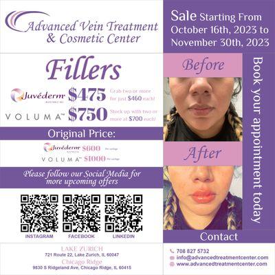 Grand Sale on Fillers by Juvederm and Voluma - valid from the 16th of October to 30th of November 2023