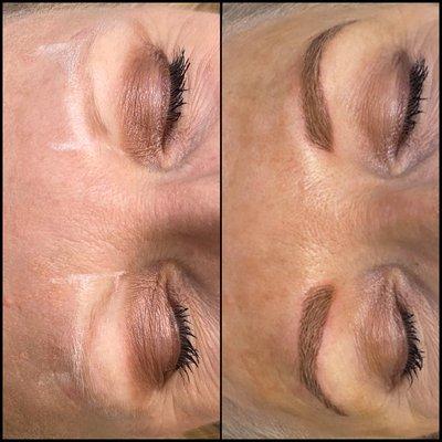 Microblading