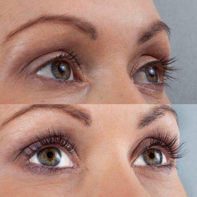 Lash Lift