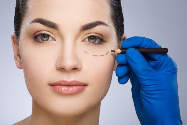 Dermal Fillers