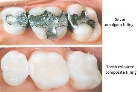 Composite Before & After