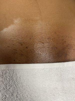 After pic of clean Brazilian wax