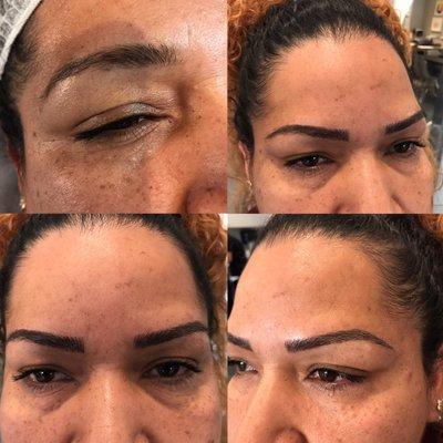 Before|After microblading