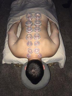 Massage cupping.