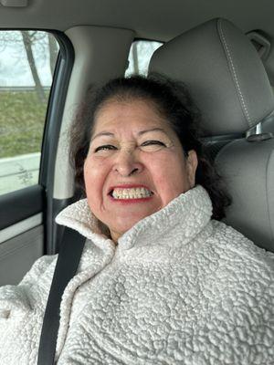 My mother smiling after her partial upper/ lower denture delivery