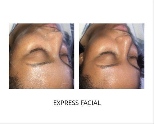 Express Facial