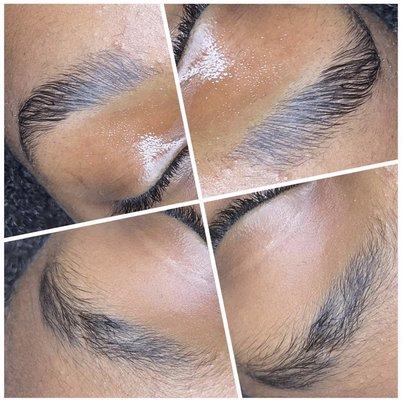 Instant Brow Lift